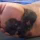 Melanoma skin cancer