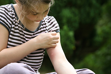 Girl with insect bite